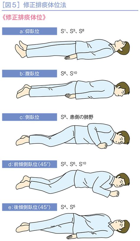 左側位|左側臥位